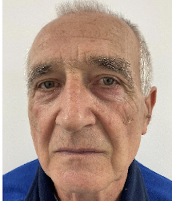 Jozo Žigić