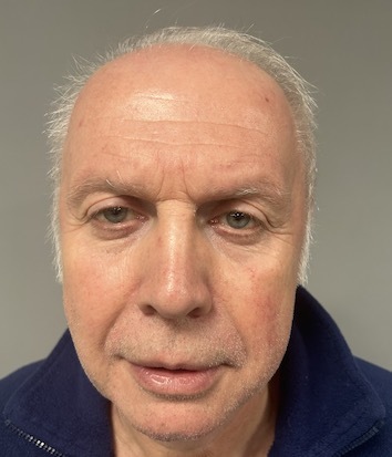 Igor Džeko