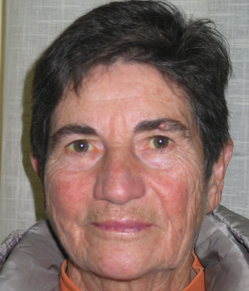 Vilma Miškić